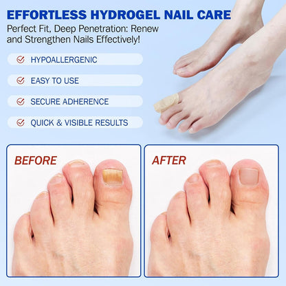 ZeroFungex™ Anti-Fungal Nail Repair Patches